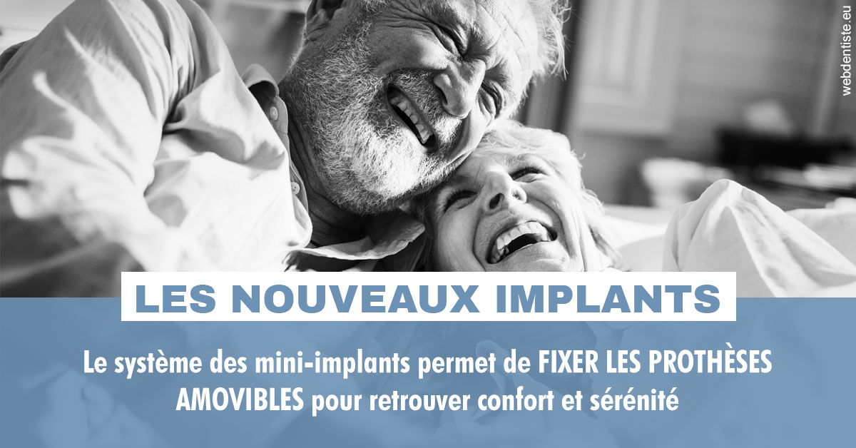 https://www.centre-dentaire-archereau-paris19.fr/Les nouveaux implants 2