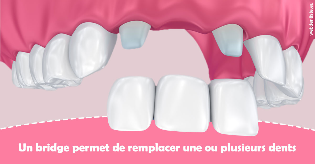 https://www.centre-dentaire-archereau-paris19.fr/Bridge remplacer dents 2