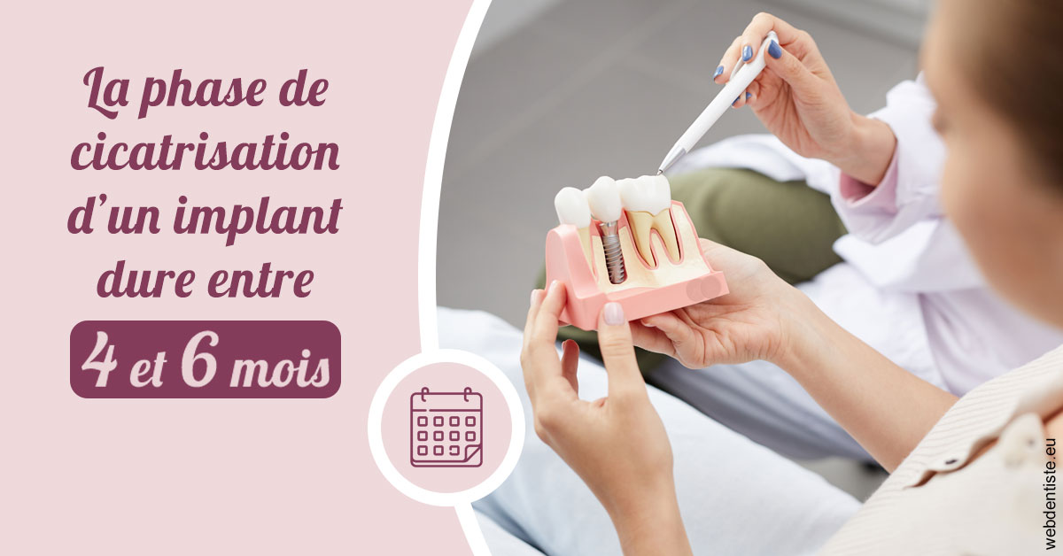 https://www.centre-dentaire-archereau-paris19.fr/Cicatrisation implant 2