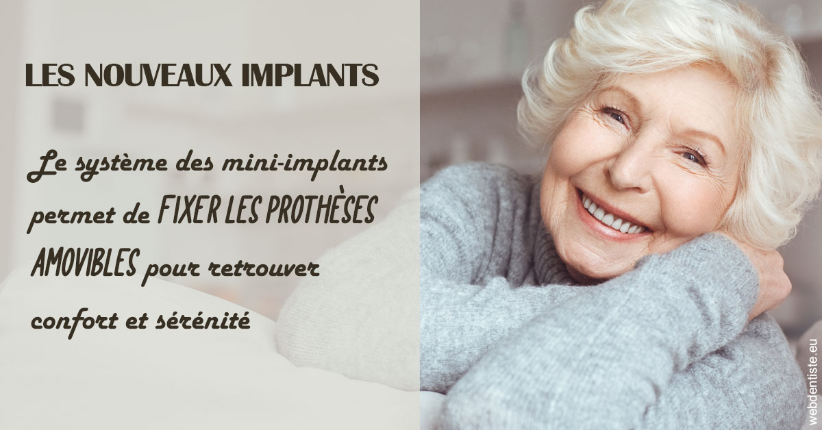 https://www.centre-dentaire-archereau-paris19.fr/Les nouveaux implants 1