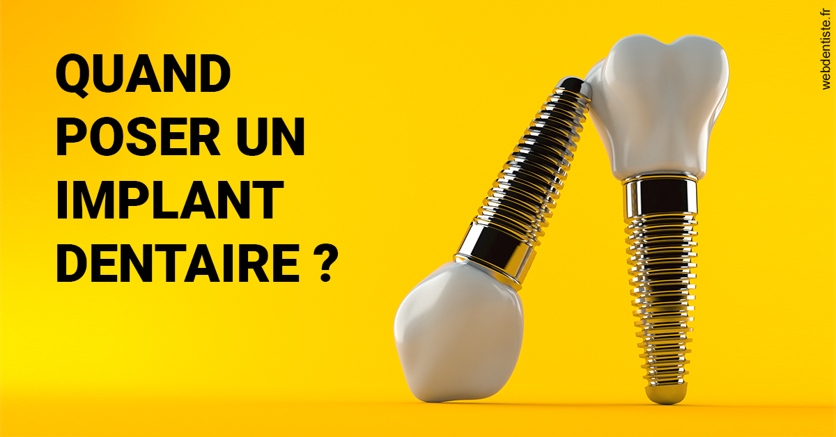 https://www.centre-dentaire-archereau-paris19.fr/Les implants 2
