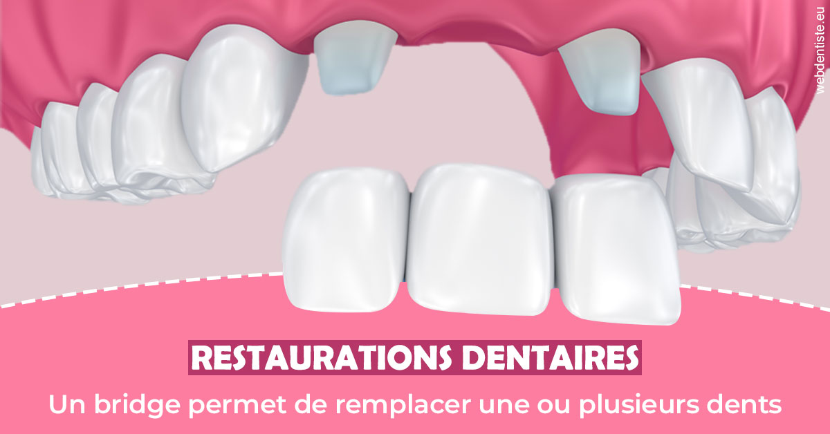 https://www.centre-dentaire-archereau-paris19.fr/Bridge remplacer dents 2