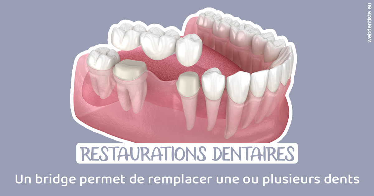 https://www.centre-dentaire-archereau-paris19.fr/Bridge remplacer dents 1