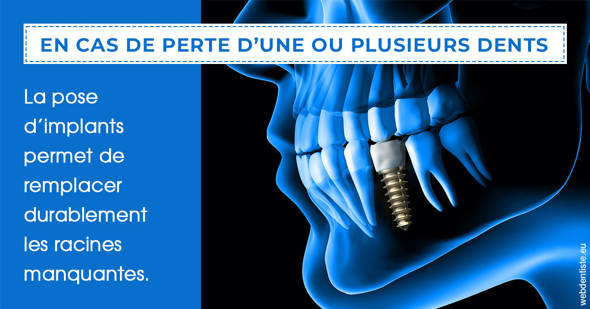 https://www.centre-dentaire-archereau-paris19.fr/2024 T1 - Implants 01