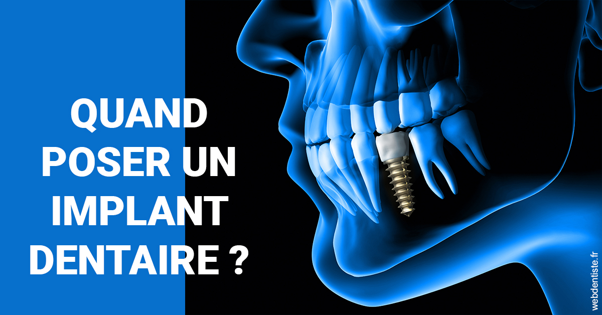 https://www.centre-dentaire-archereau-paris19.fr/Les implants 1