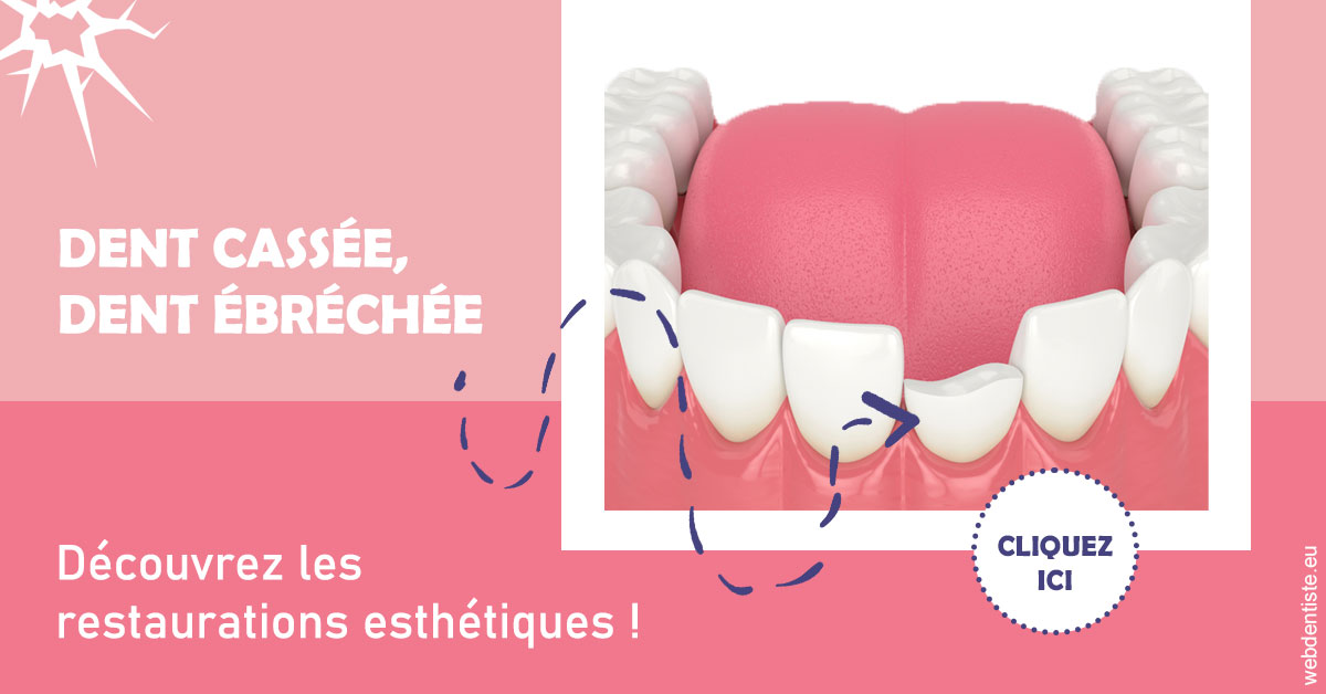 https://www.centre-dentaire-archereau-paris19.fr/Dent cassée ébréchée 1
