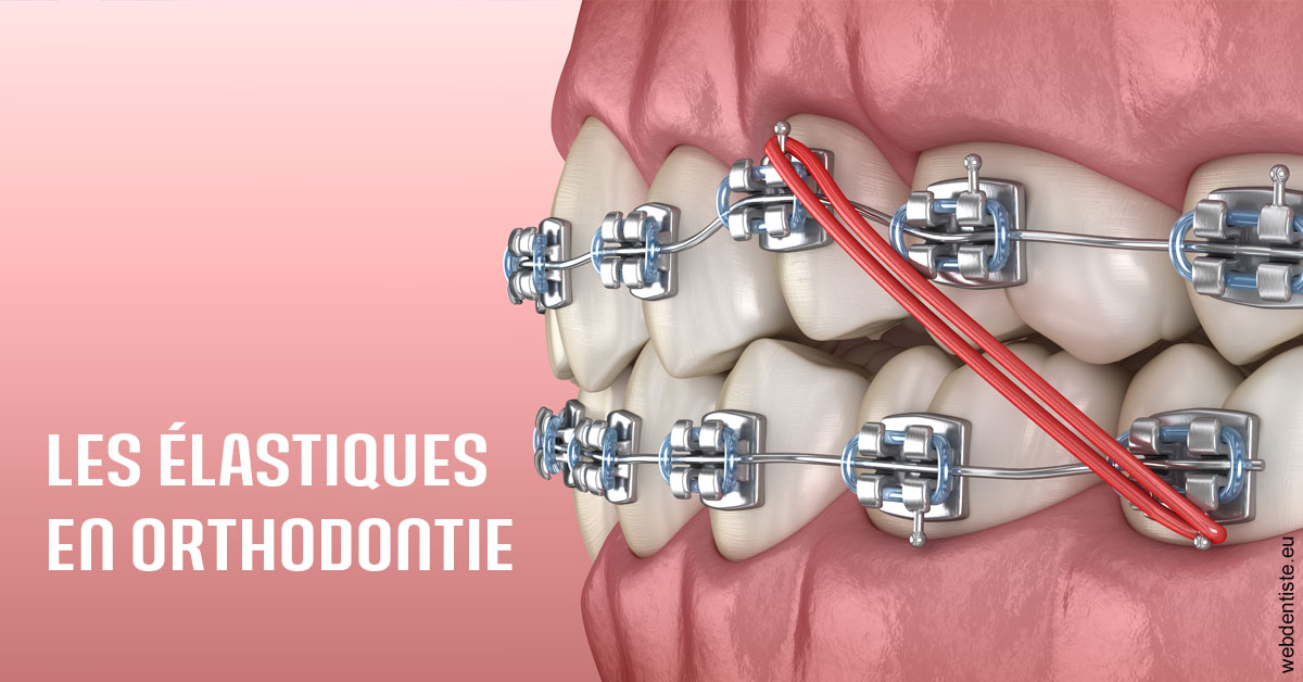 https://www.centre-dentaire-archereau-paris19.fr/Elastiques orthodontie 2