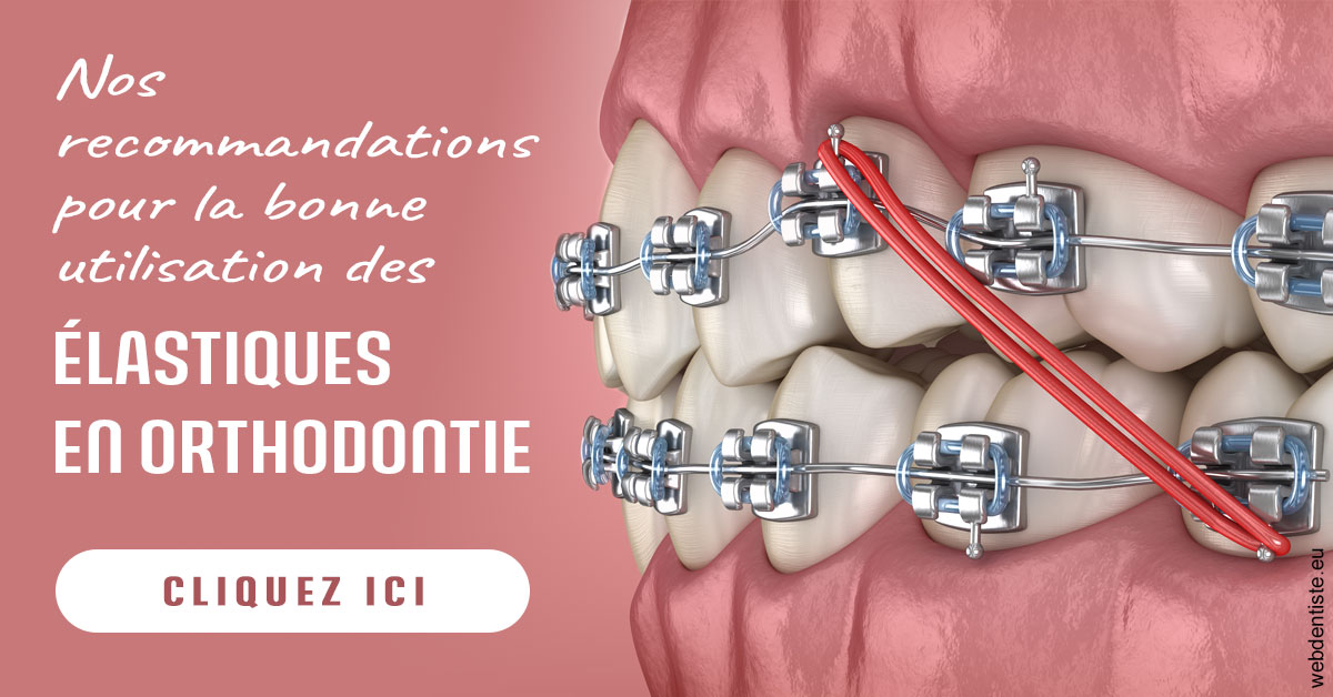 https://www.centre-dentaire-archereau-paris19.fr/Elastiques orthodontie 2